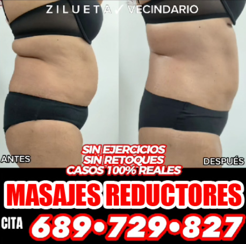 masajes reductores en vecindario